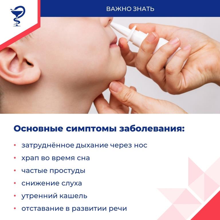 аденоиды