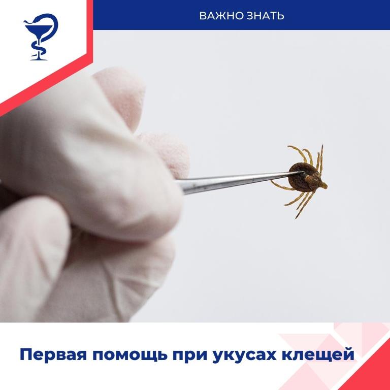 клещи